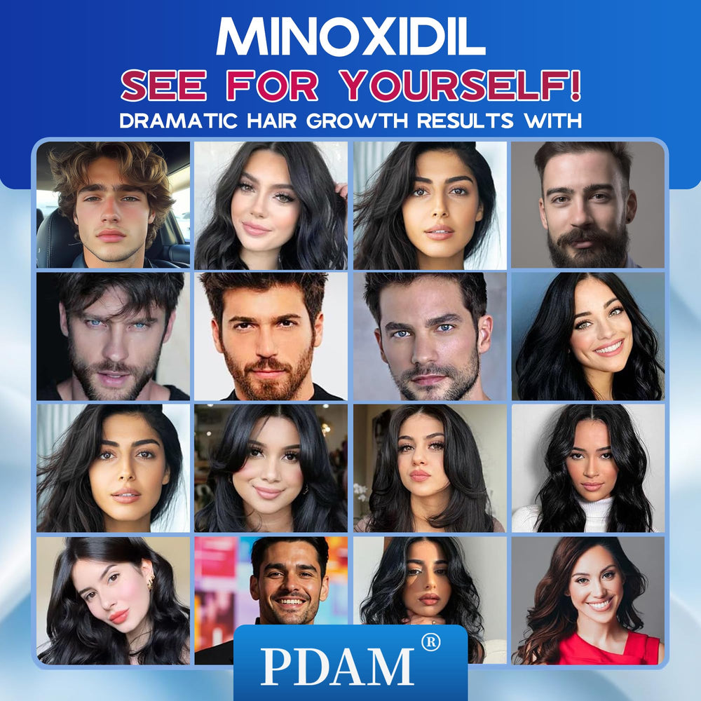Pdam minoxidil-foam-non-greasy-residue label communicates a clean scalp experience.