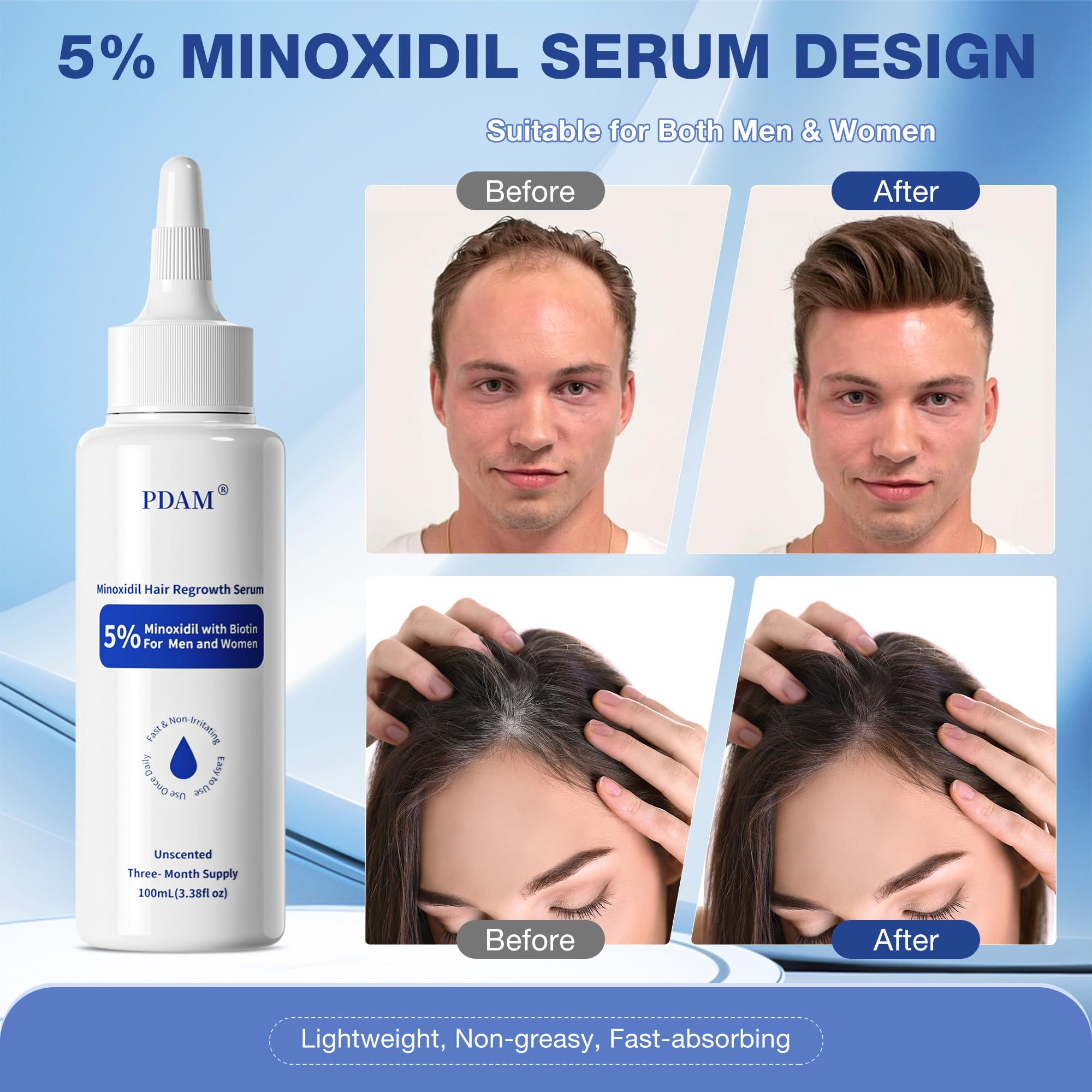 Pdam Minoxidil product packaging box with brand details and usage notes.