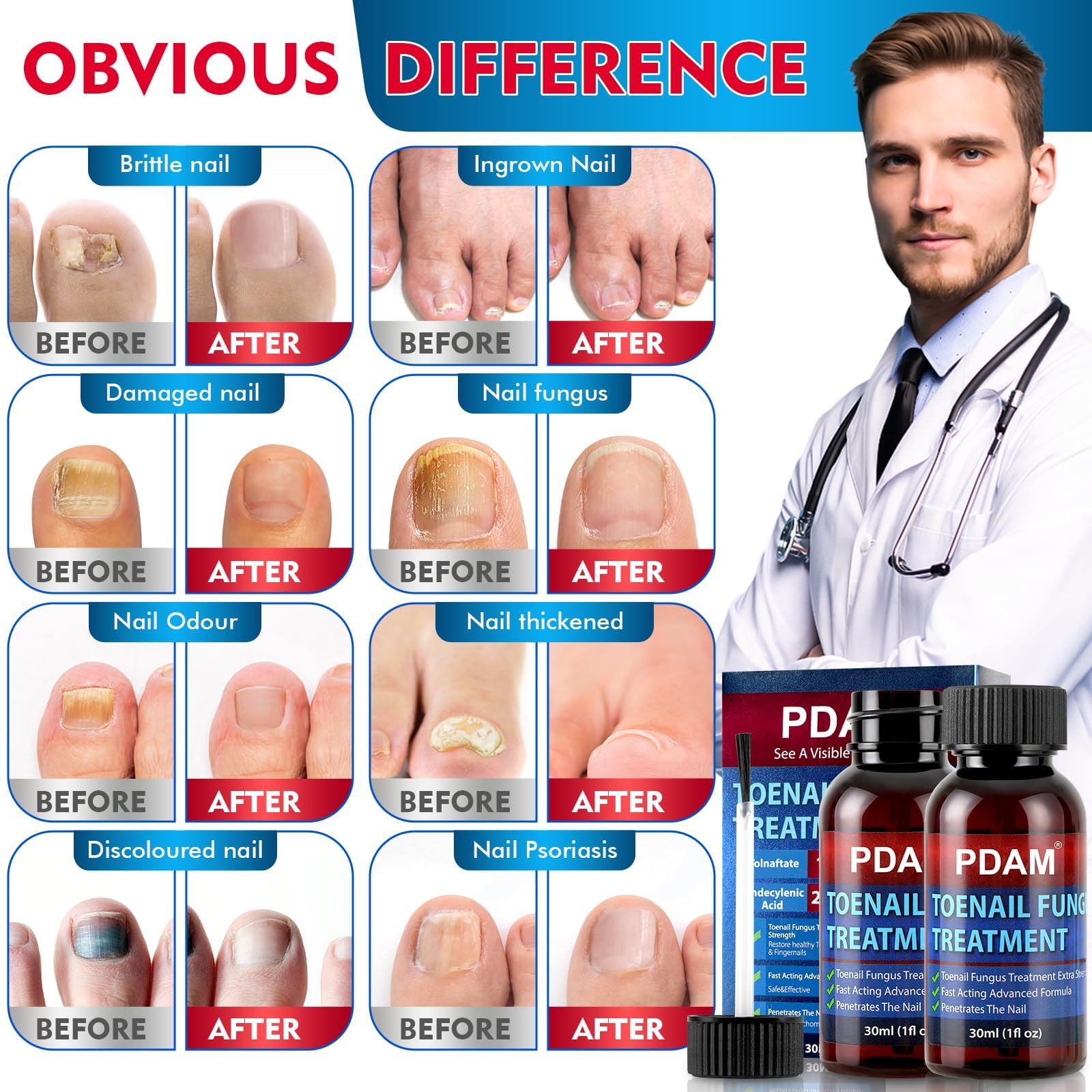 PDAM nail-strengthening serum visual emphasizes growth support for nails