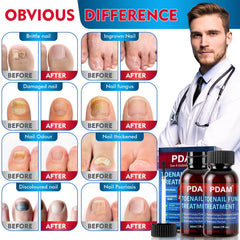 PDAM nail-strengthening serum visual emphasizes growth support for nails