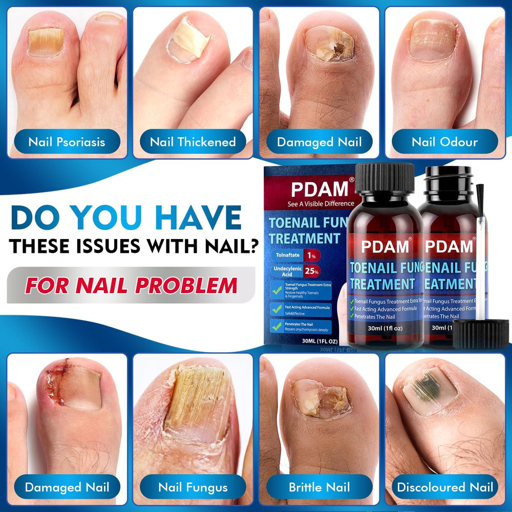 PDAM toenail fungus treatment application demonstrates twice-daily usage for healthier nails