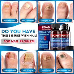 PDAM toenail fungus treatment application demonstrates twice-daily usage for healthier nails