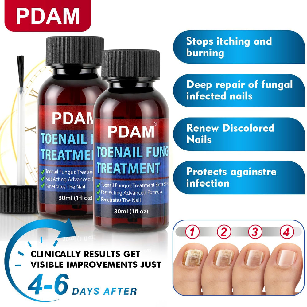 PDAM toenail fungus treatment dropper highlights fast-penetration formula for discreet use