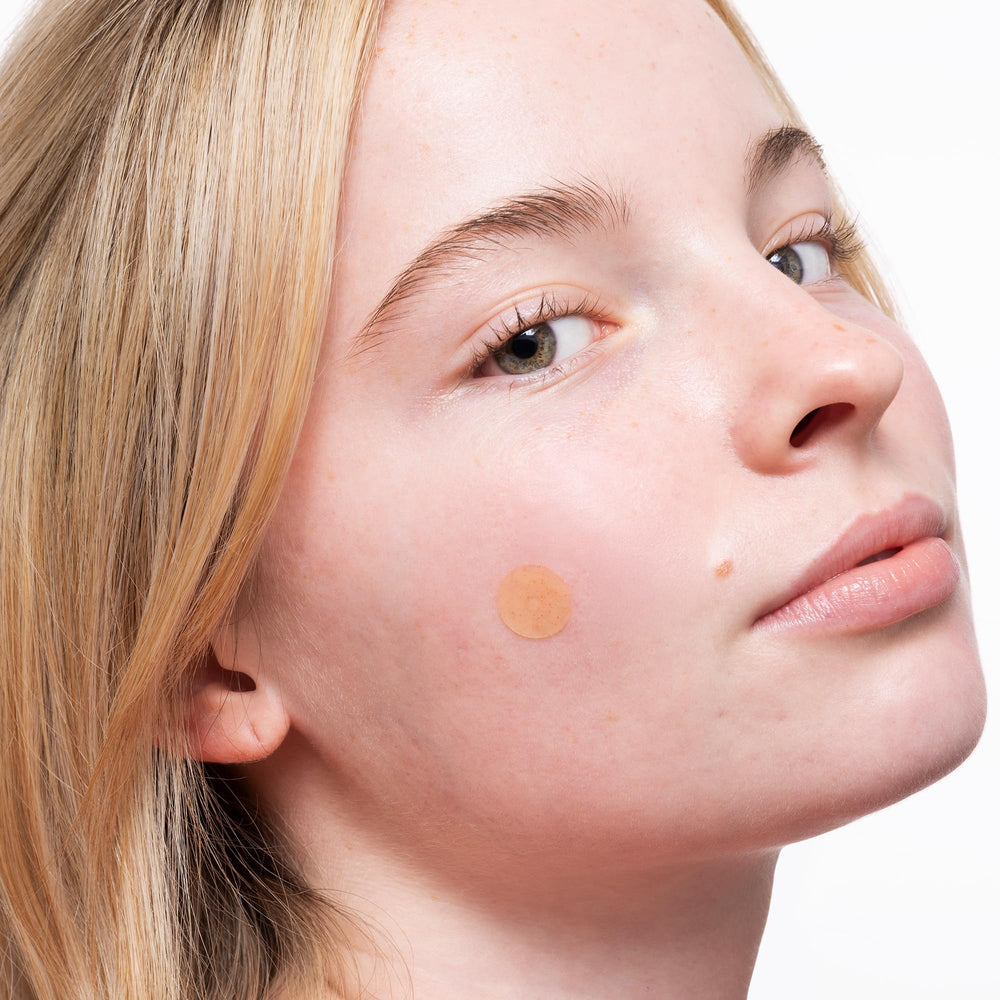 Peace Out Acne Healing Dots overnight use shows potential blemish reduction by morning.