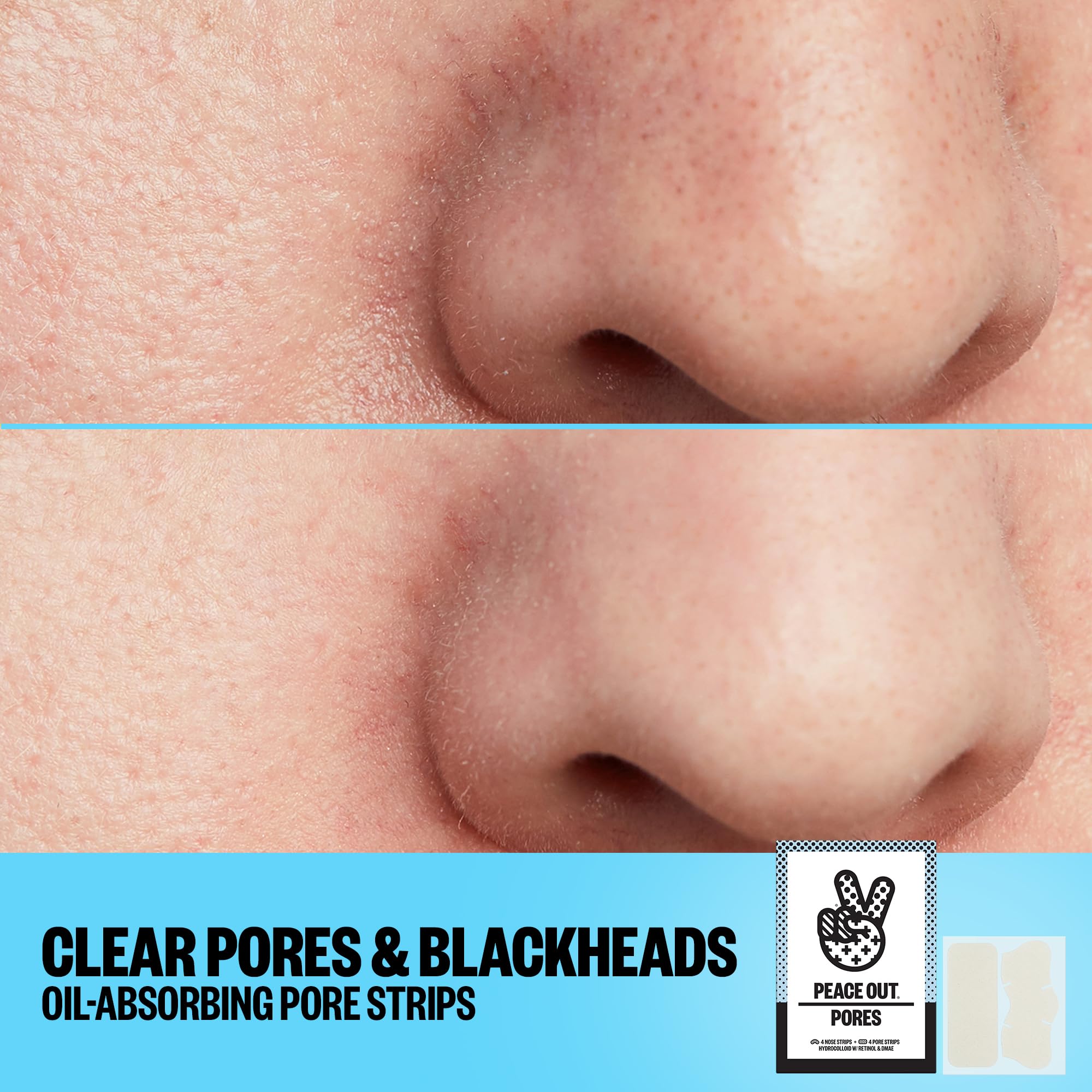 Peace Out Pores packaging image shows eight strips included in the kit.