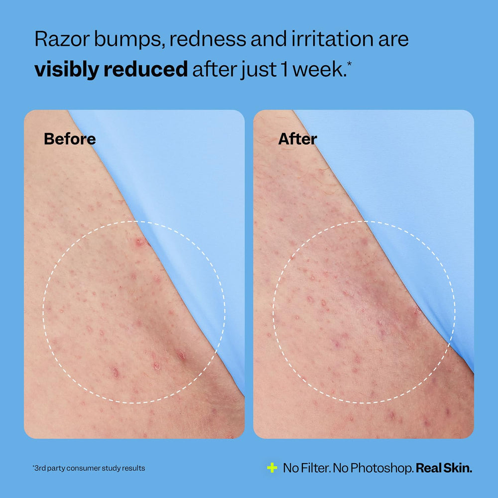 Peach Slices Smoothing Solution neck application, promotes even-toned, calmer skin