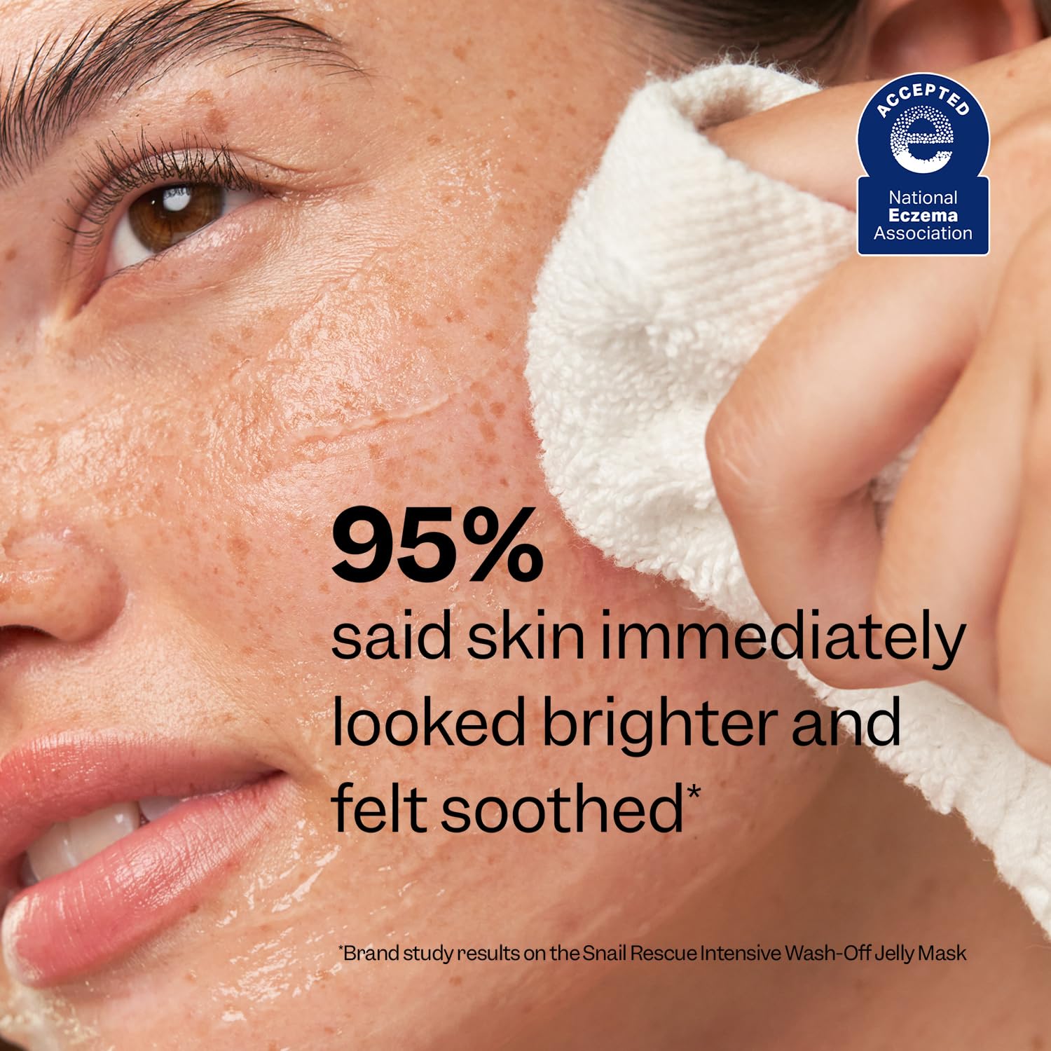 Peach Slices Snail Rescue mask on skin closeup hints at calming redness.