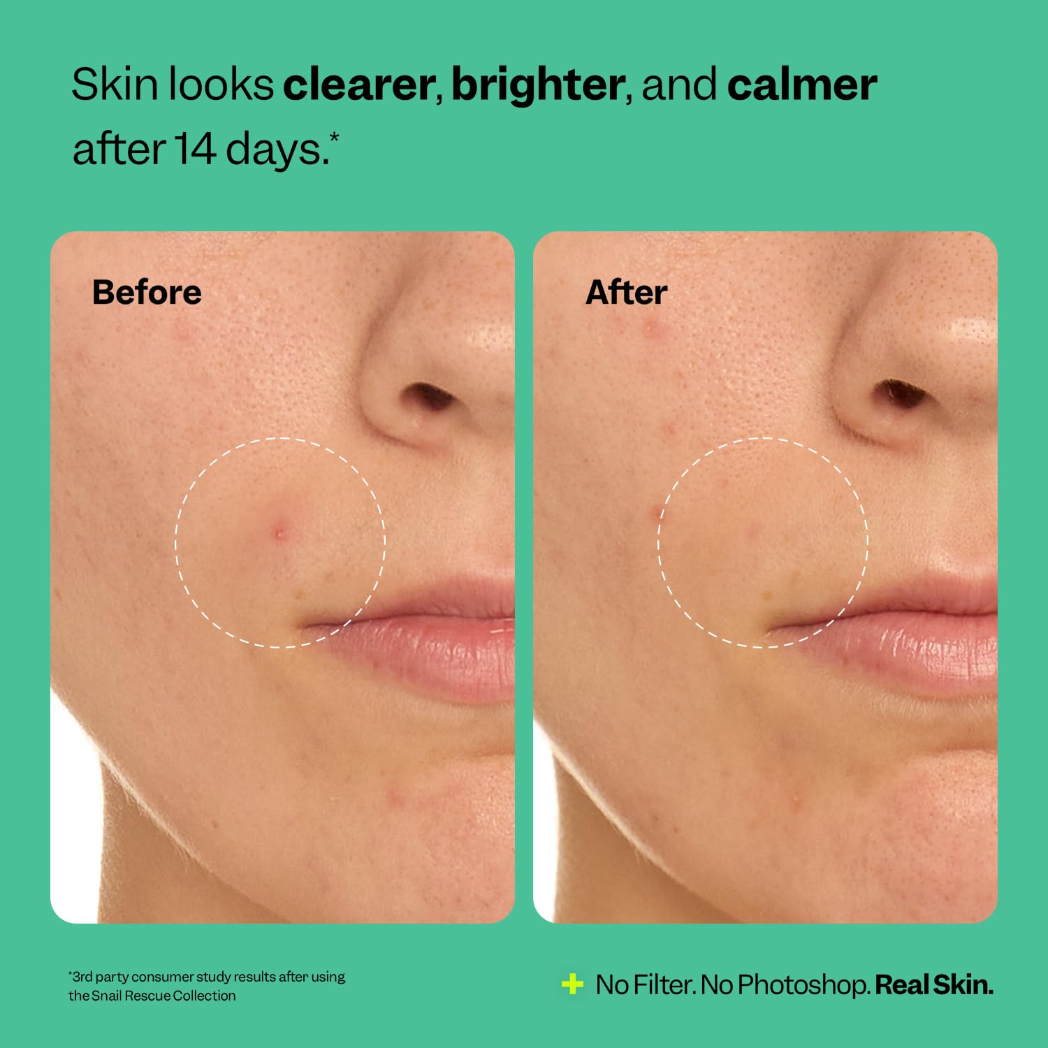 Peach Slices Snail Rescue Purifying Cleanser balance-skin shot suggests calm, clean complexion.