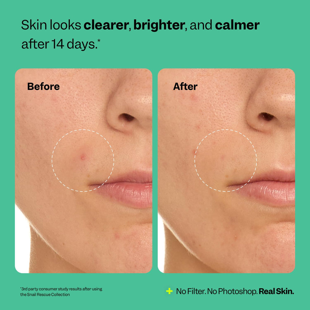 Peach Slices Snail Rescue Purifying Cleanser balance-skin shot suggests calm, clean complexion.