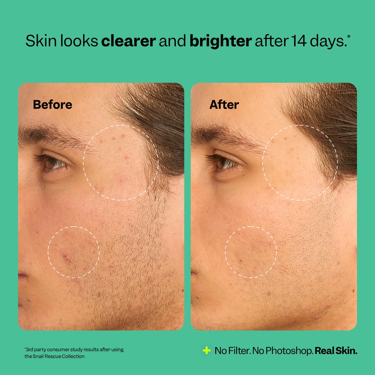 Peach Slices Snail Rescue Toner highlights hyaluronic acid for lasting moisture