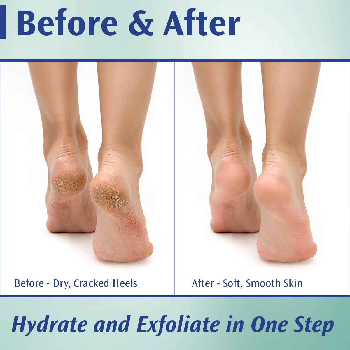 Pedifix Podiatrists' Choice label shot signals trusted professional-grade foot care.
