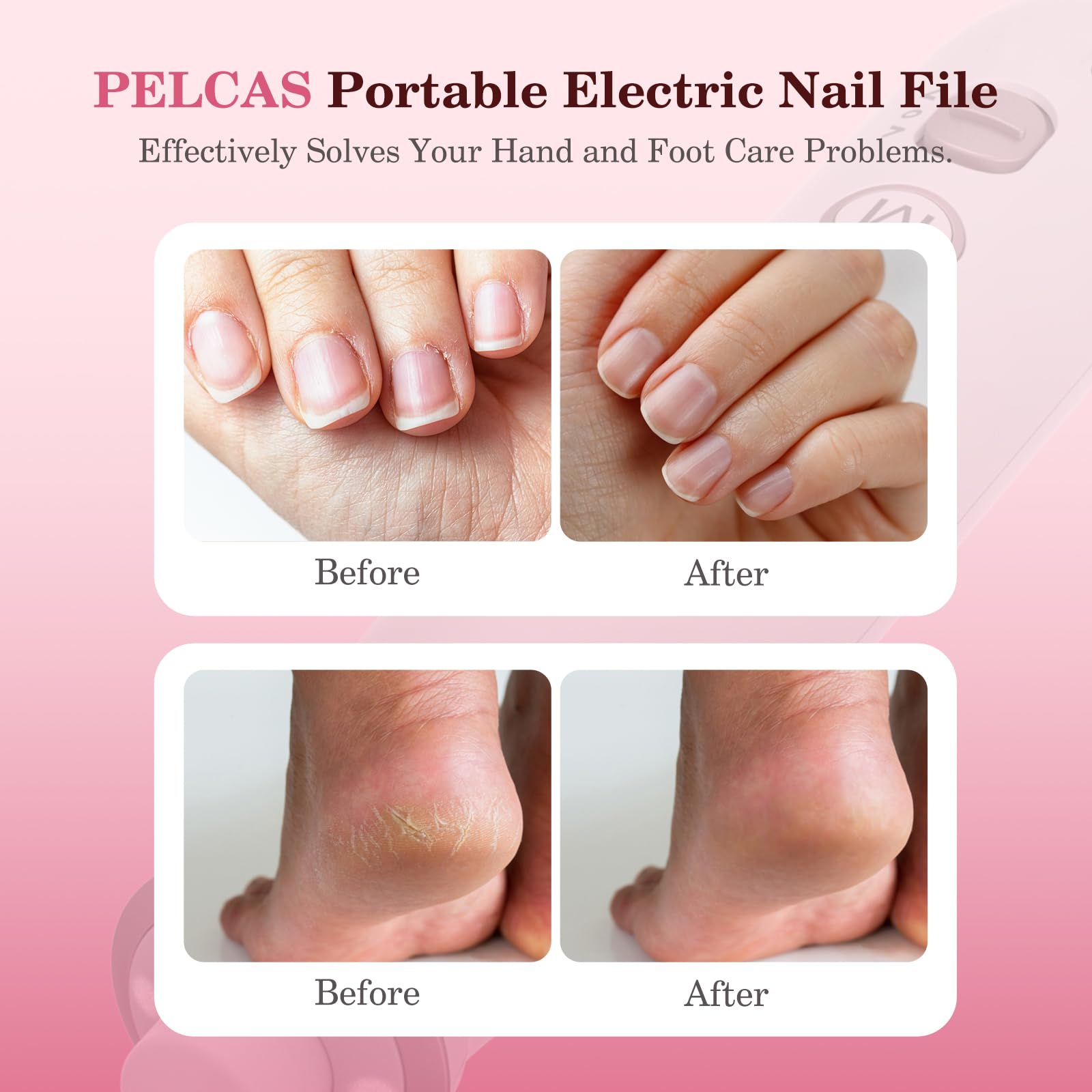 PEL CAS cordless nail drill kit offers portable salon-quality nails at home.