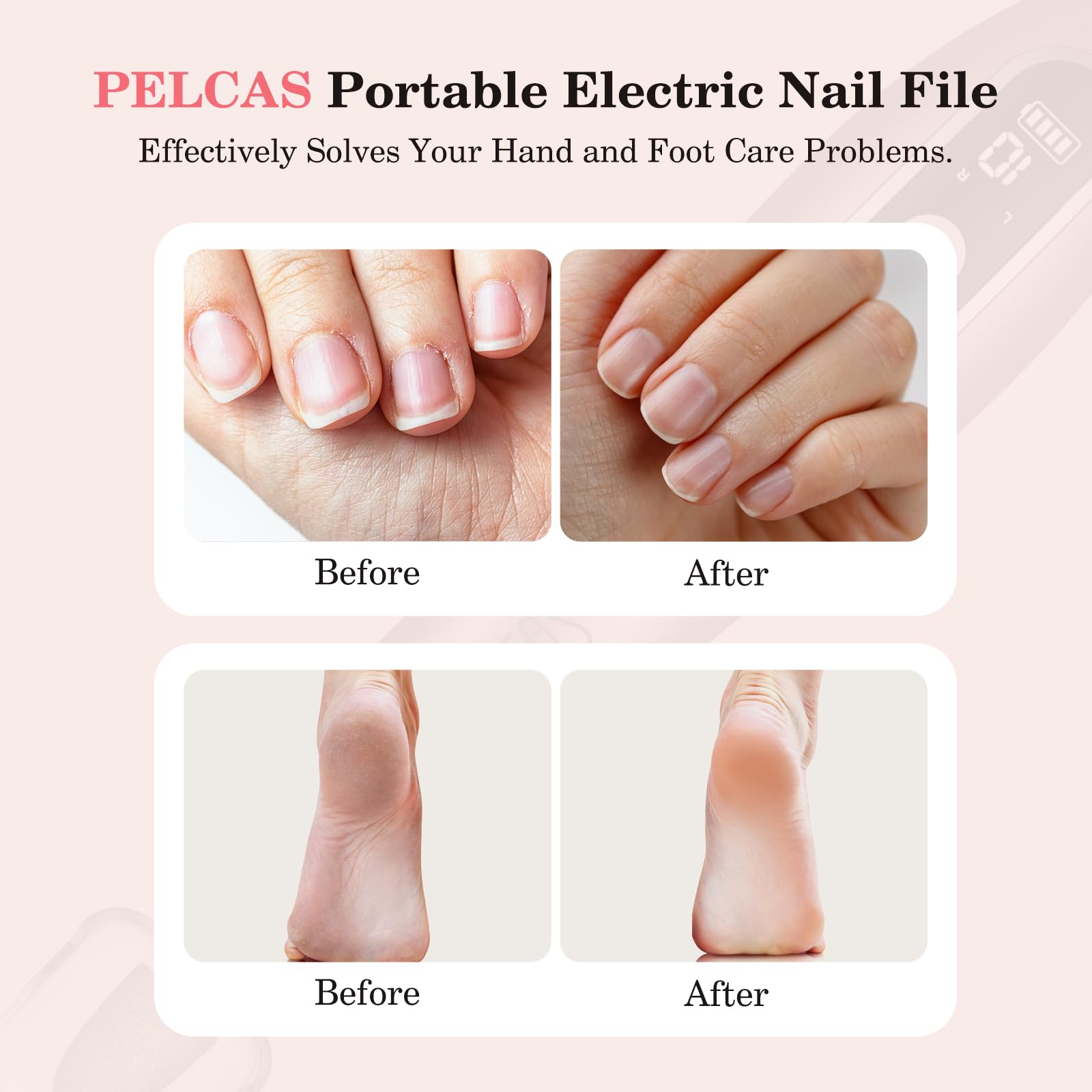 PELCAS Electric Nail File shows 360° LED lighting for clear visibility.