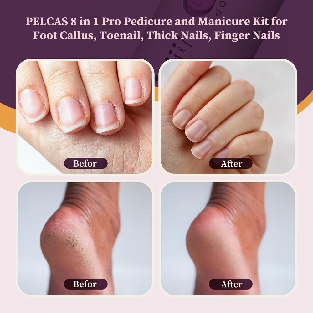 PELCA S led-light-nail-file for precise grooming in low light.