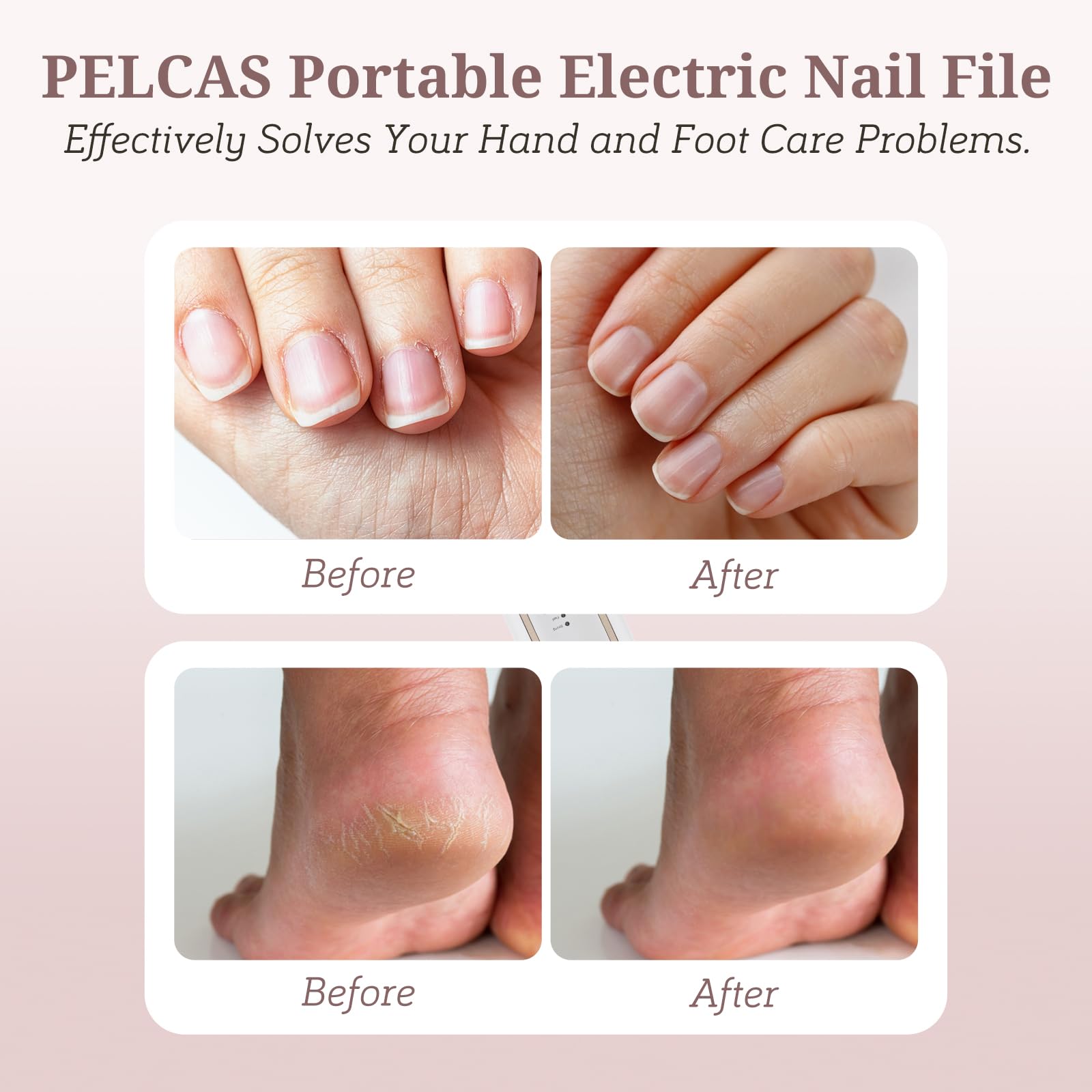 Pelcas 8-in-1 nail drill kit for versatile at-home manicures and pedicures.