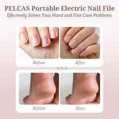 Pelcas 8-in-1 nail drill kit for versatile at-home manicures and pedicures.