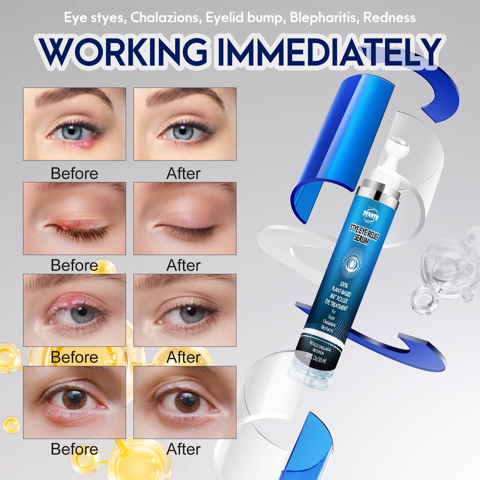 PENNTR Stye Eye Treatment natural-origin ingredients for sensitive skin