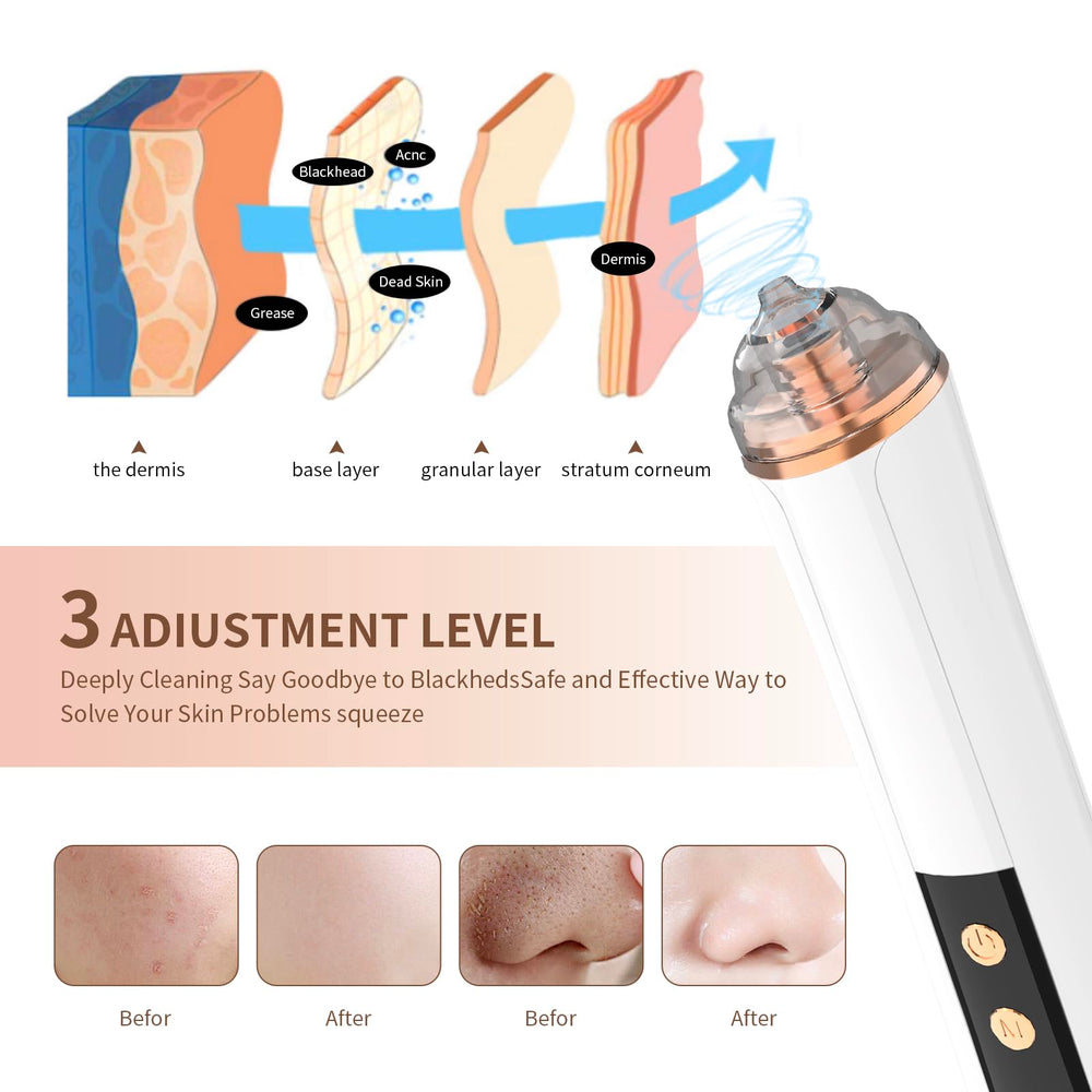 PENSVOX blackhead vacuum suction levels close-up for customizable pore cleaning.