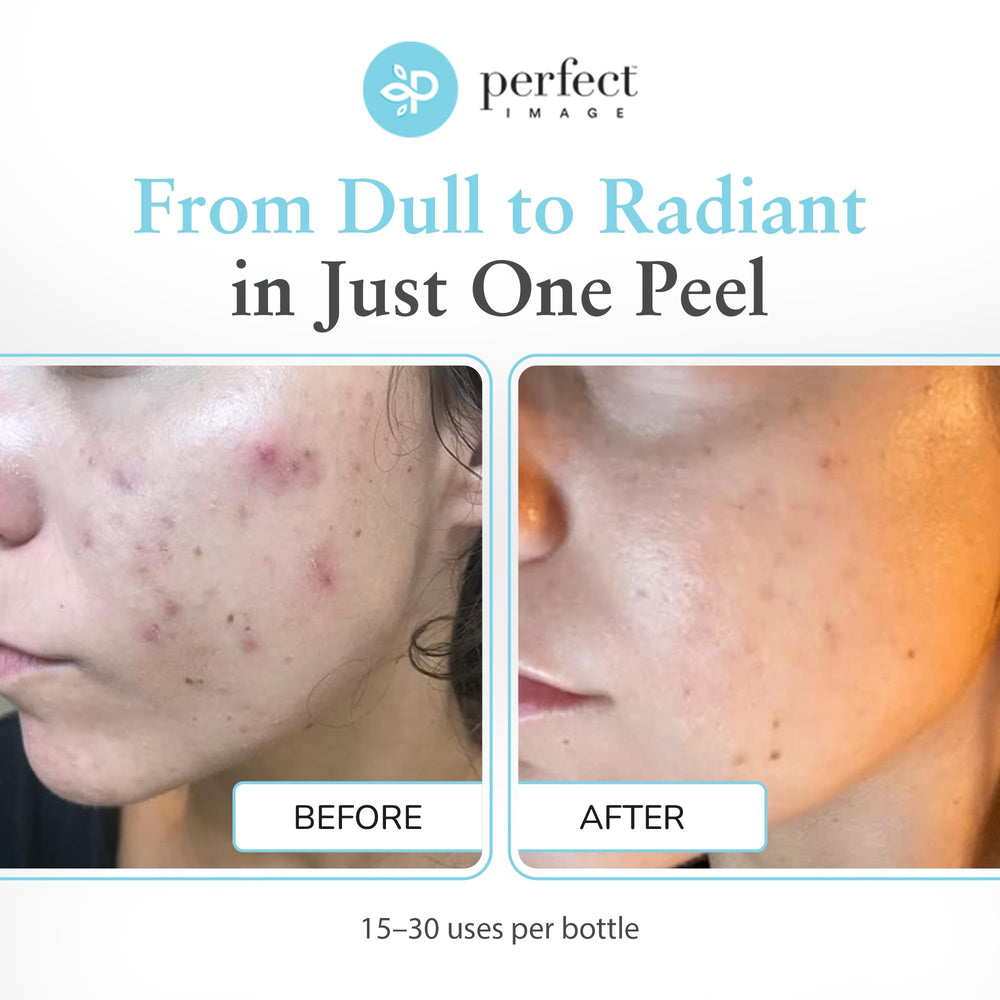 Perfect Image Glycolic 30% Gel Peel with green tea extract highlights antioxidant skin support.