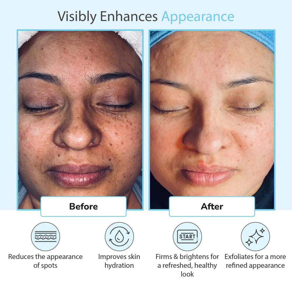 Perfect Image Glycolic 50% Peel label emphasizes professional use and skincare benefits.