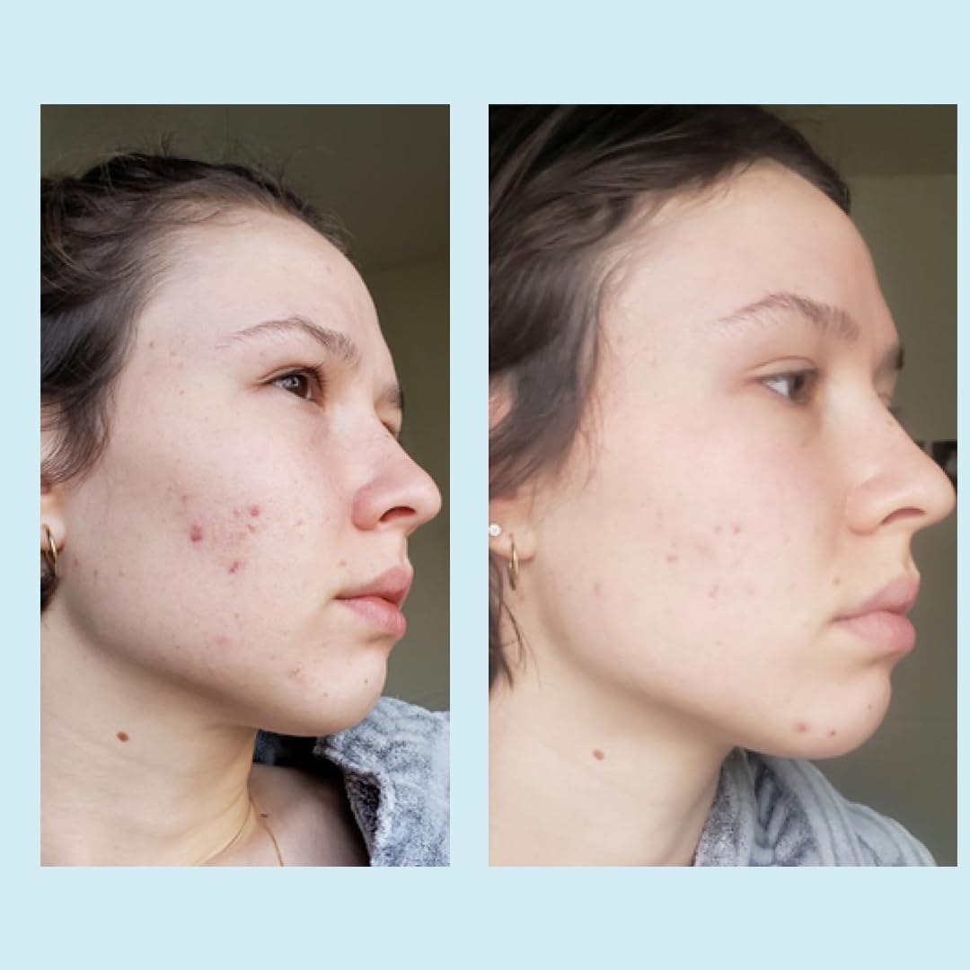 Perfect Image Glycolic 50% Peel box set showcases complete professional skincare experience.