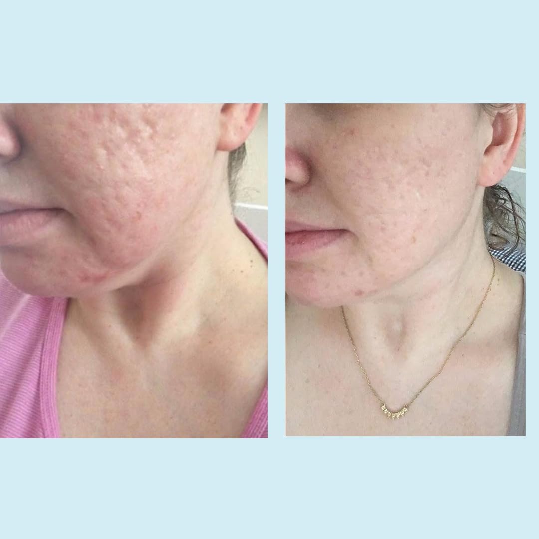 Perfect Image Glycolic 50% Peel ingredients list communicates advanced exfoliation.