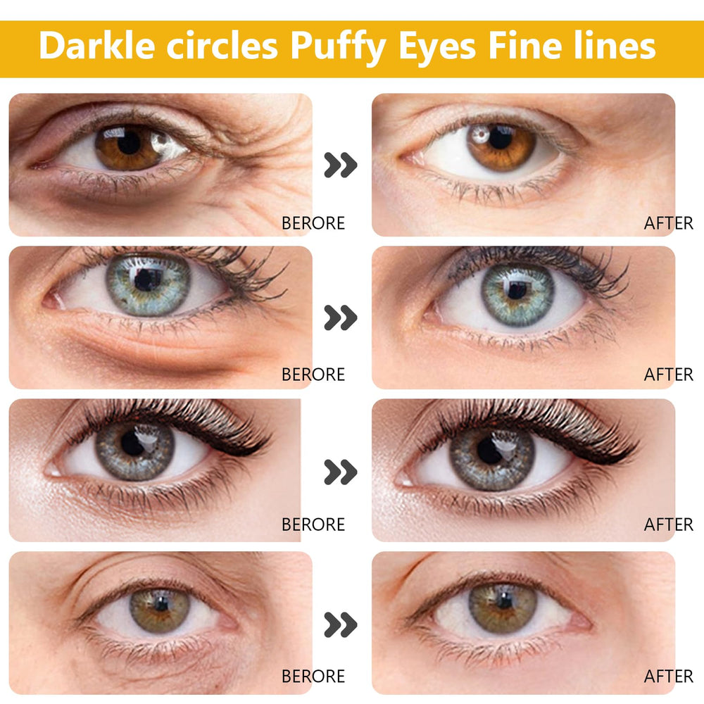 Permotary under-eye patch close-up highlighting moisturizing, de-puffing skin under eyes