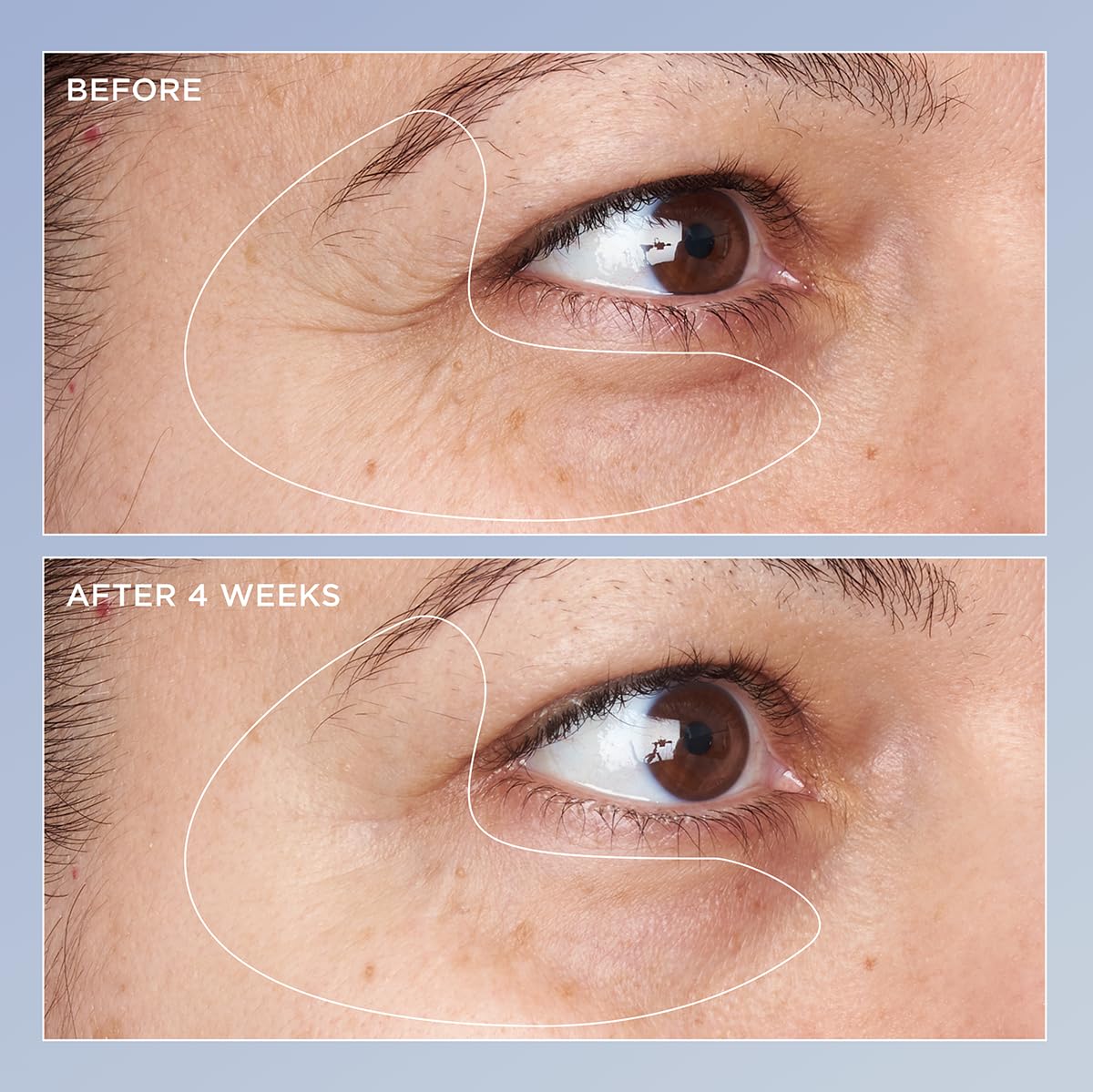 Perricone MD COQ10 antioxidant badge on packaging suggesting brightening support.