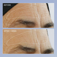 Perricone MD skin surface closeup highlighting improved texture and radiance.