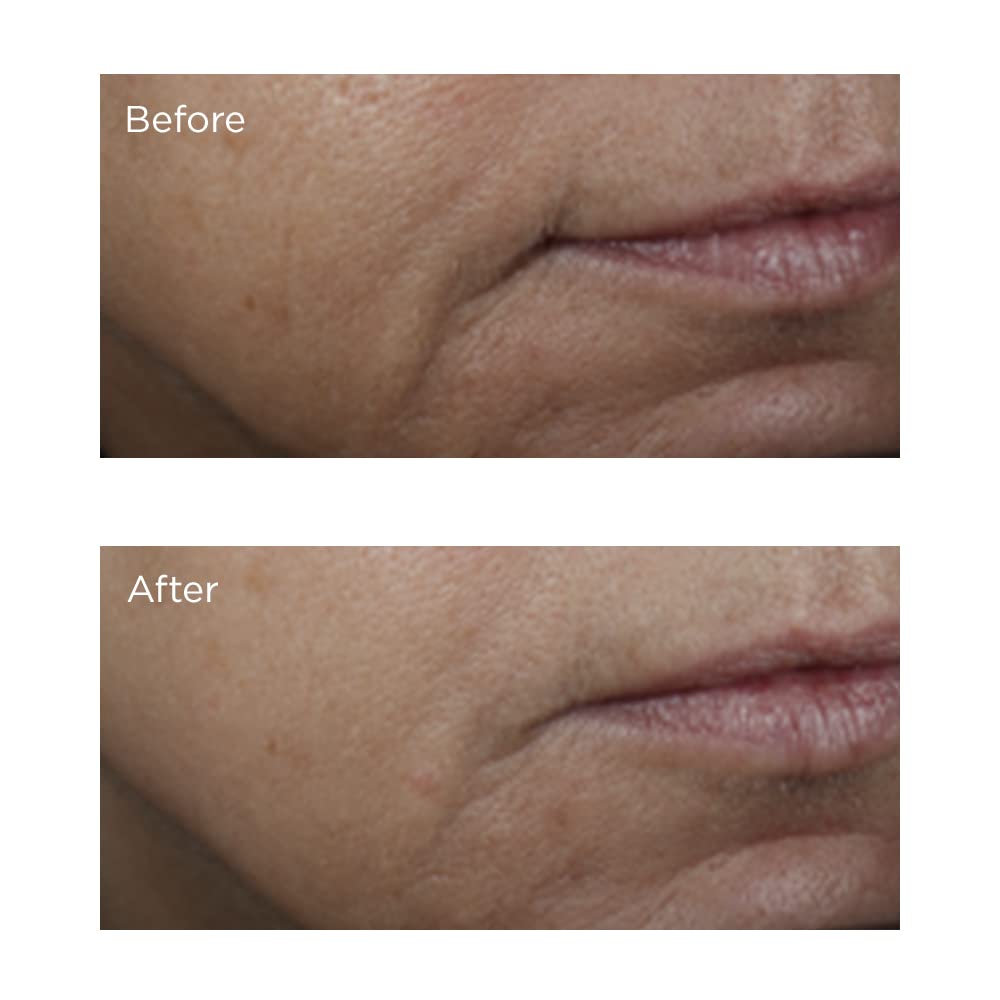 Perricone MD Vitamin C Ester day routine image showing brightening steps.