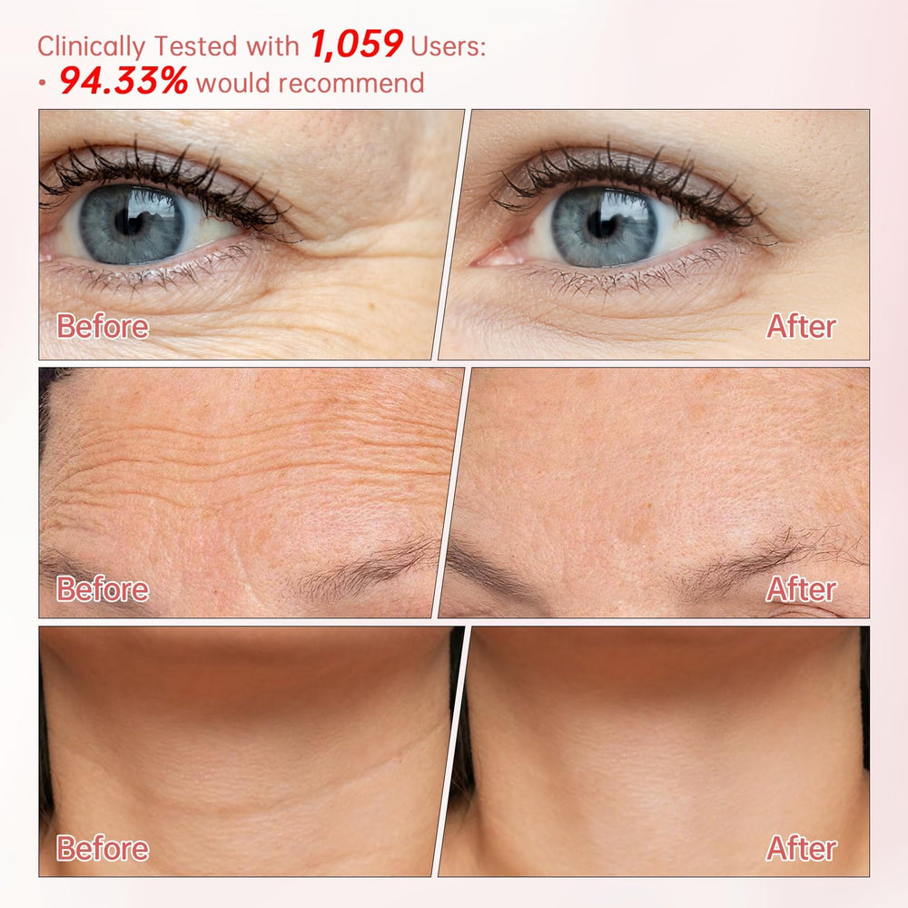 Peunitory Eye Balm Stick under-eye glide aiding gentle nourishment