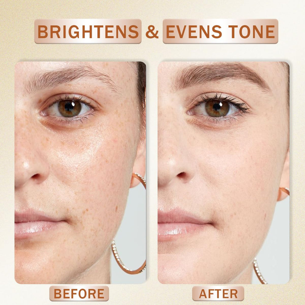 Peunitory Vitamin C Serum brightening glow image illustrates even-toned radiance.