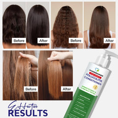 PHARMBANNER Folliculitis conditioner-smoothing-detangle enables easy frizz control.