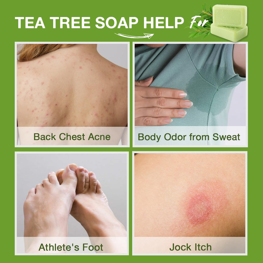 PHARMBANNER Tea Tree Antifungal Soap Bar after-work shower relief ritual