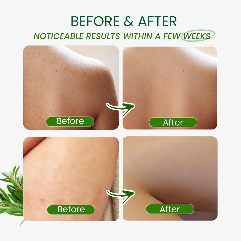 PHARMBANNER Tea Tree Body Wash in a spa-like setting suggesting antifungal and deodorizing benefits.