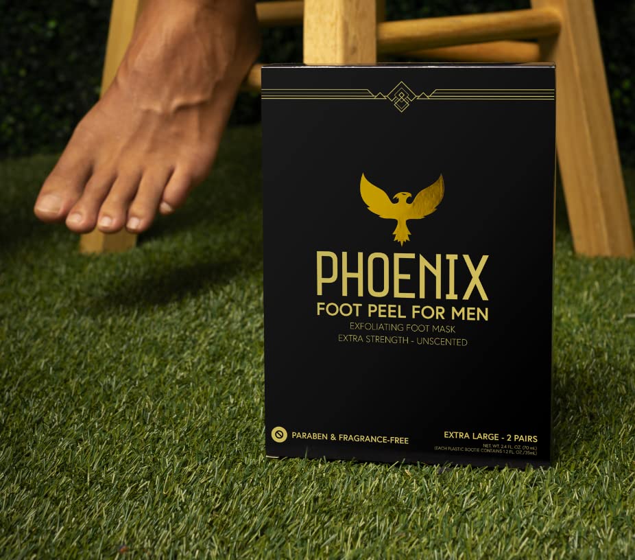 Phoenix Foot Peel for Men before feet with visible calluses.