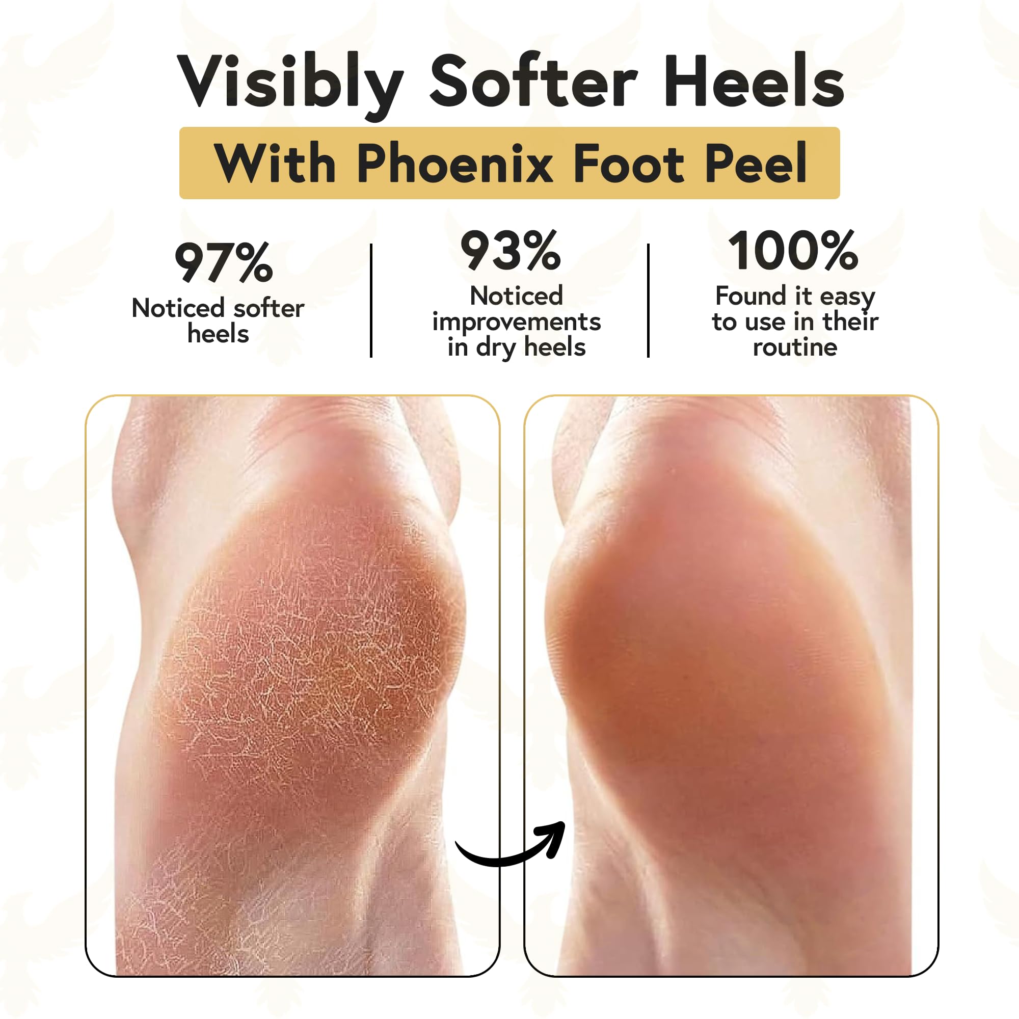 Phoenix Foot Peel silicone heel socks closeup shows moisture-sealing lining for hydration.