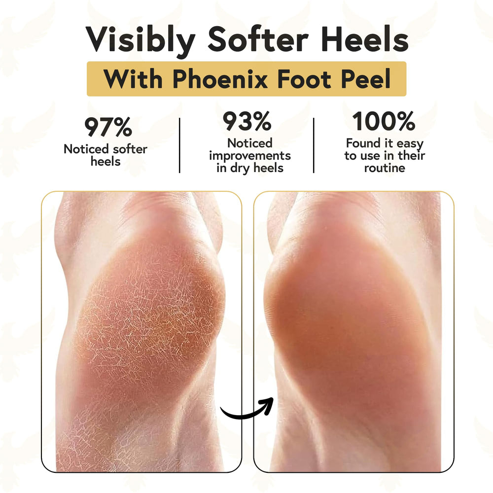 Phoenix Foot Peel silicone heel socks closeup shows moisture-sealing lining for hydration.