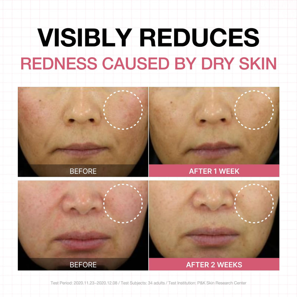 Physiogel Calming Relief fragrance-free label signals hypoallergenic formulation for sensitive skin.