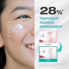 PHYSIOGEL Moisturizer Cream on the face demonstrates balanced, non-oily skin after use.