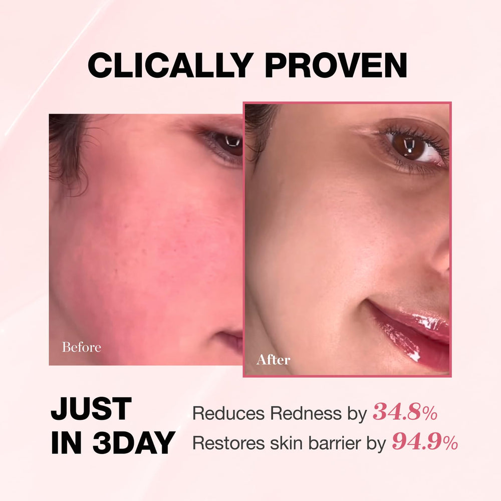 PHYSIOGEL NEA seal acceptance badge signals dermatologist-approved redness relief considerations.