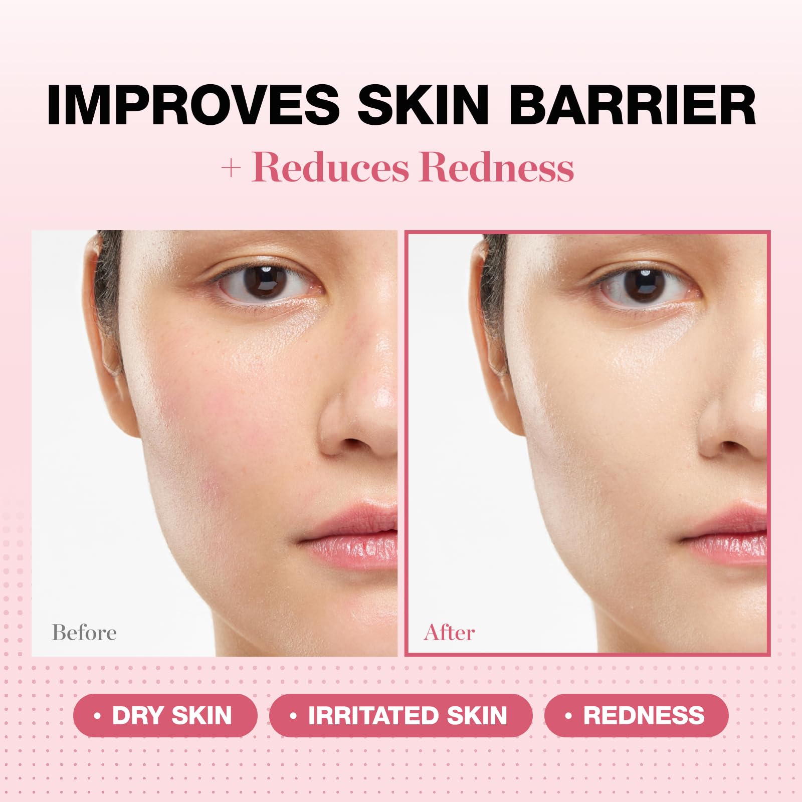 PHYSIOGEL redness-reducing cream tube dispense demonstrates easy application for dry, irritated skin.