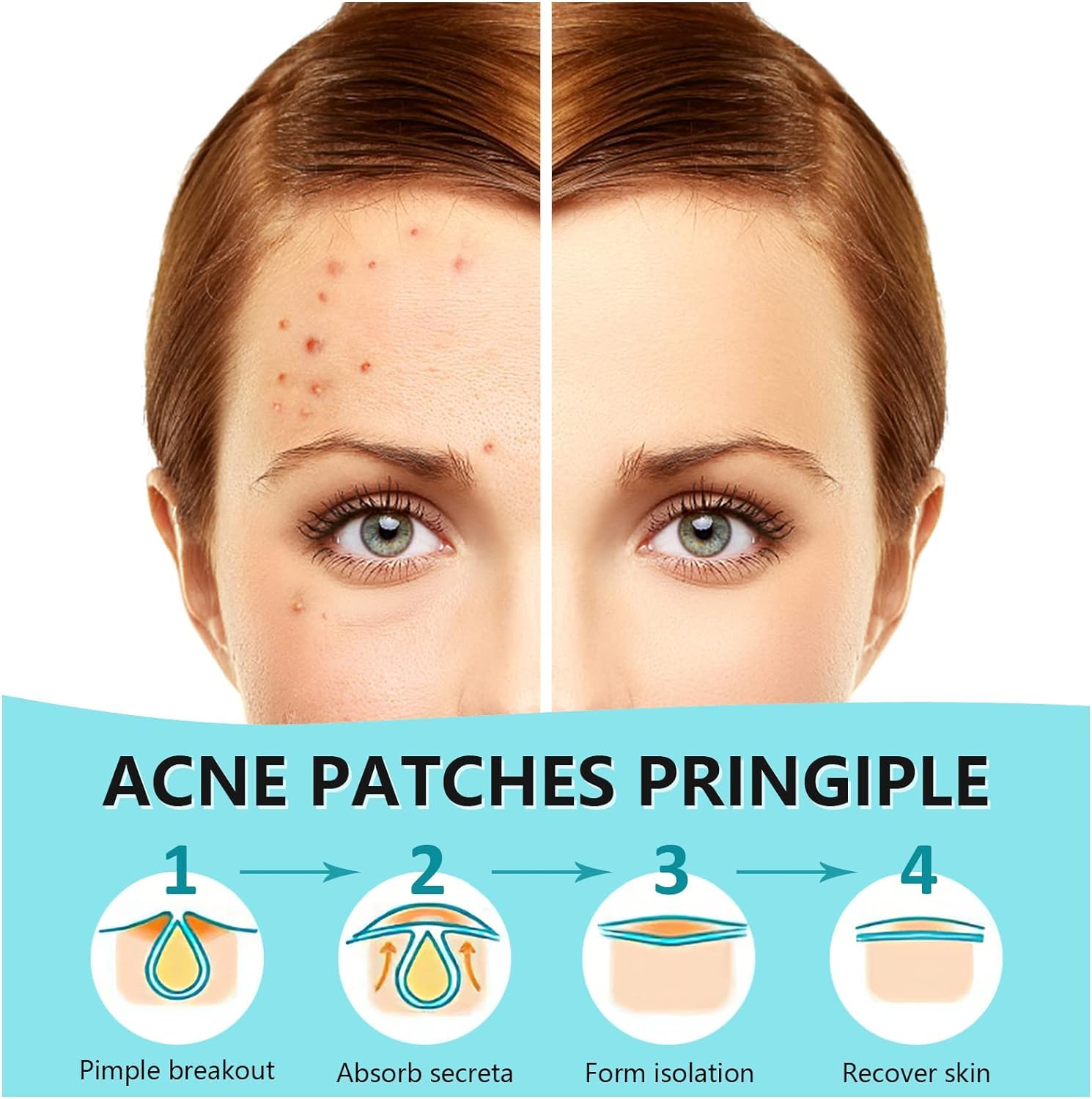 PICcircuit pimple patches invisible-on-skin demonstrate matte finish blending with complexion.