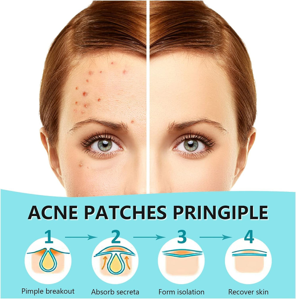 PICcircuit pimple patches invisible-on-skin demonstrate matte finish blending with complexion.