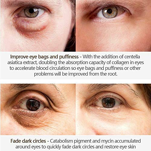 Pinnoocy Eye Cream application near under-eye area promoting smoother skin