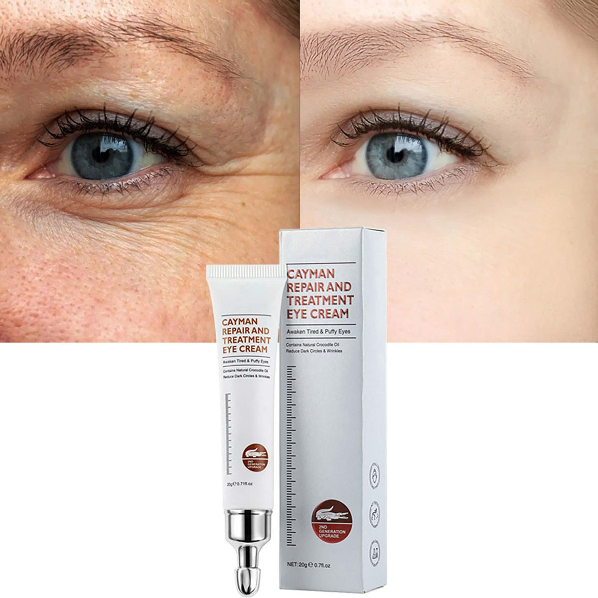 Pinnoocy Magic Eye Cream tube closeup highlighting hydrating, brightening formula for delicate eye skin