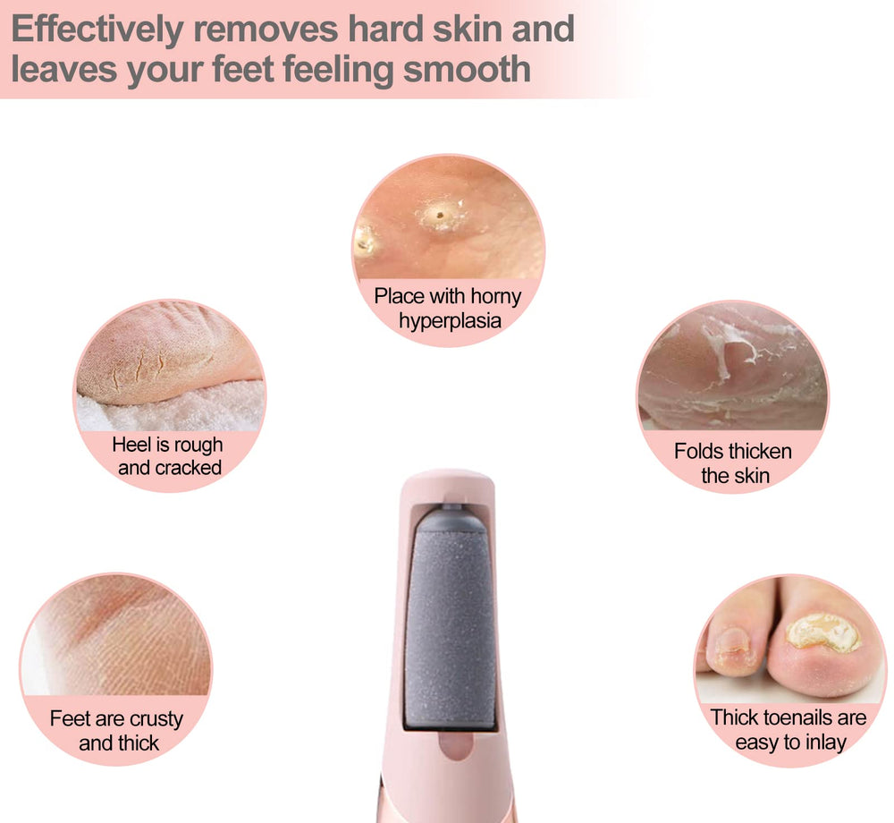 Piwerod Pedi Roller smooth-feet application demonstrates foot-smoothing potential.