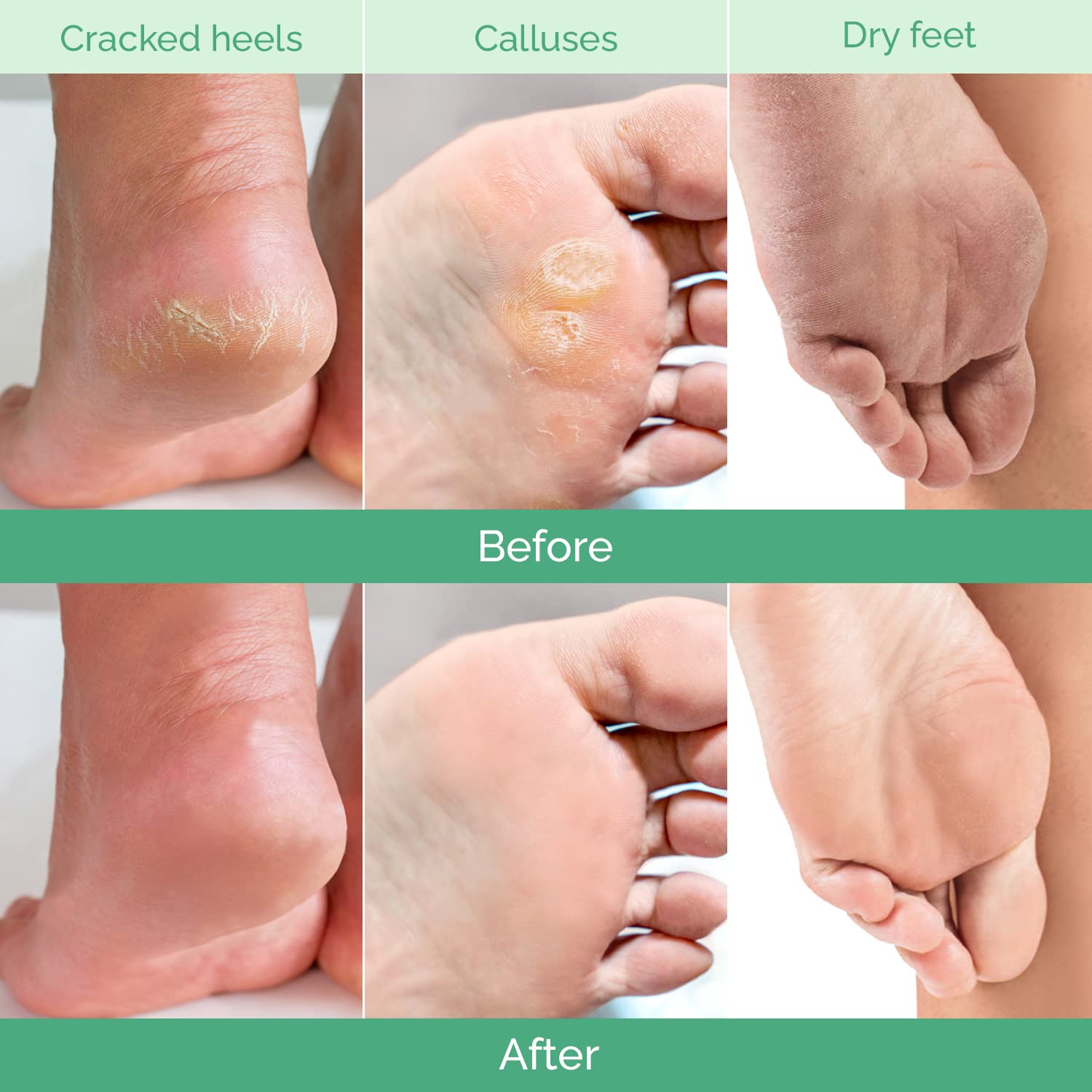PLANTIFIQUE Foot Peel Mask Peach applying the mask for gentle exfoliation at home.