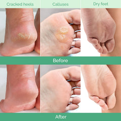 PLANTIFIQUE Foot Peel Mask Peach applying the mask for gentle exfoliation at home.