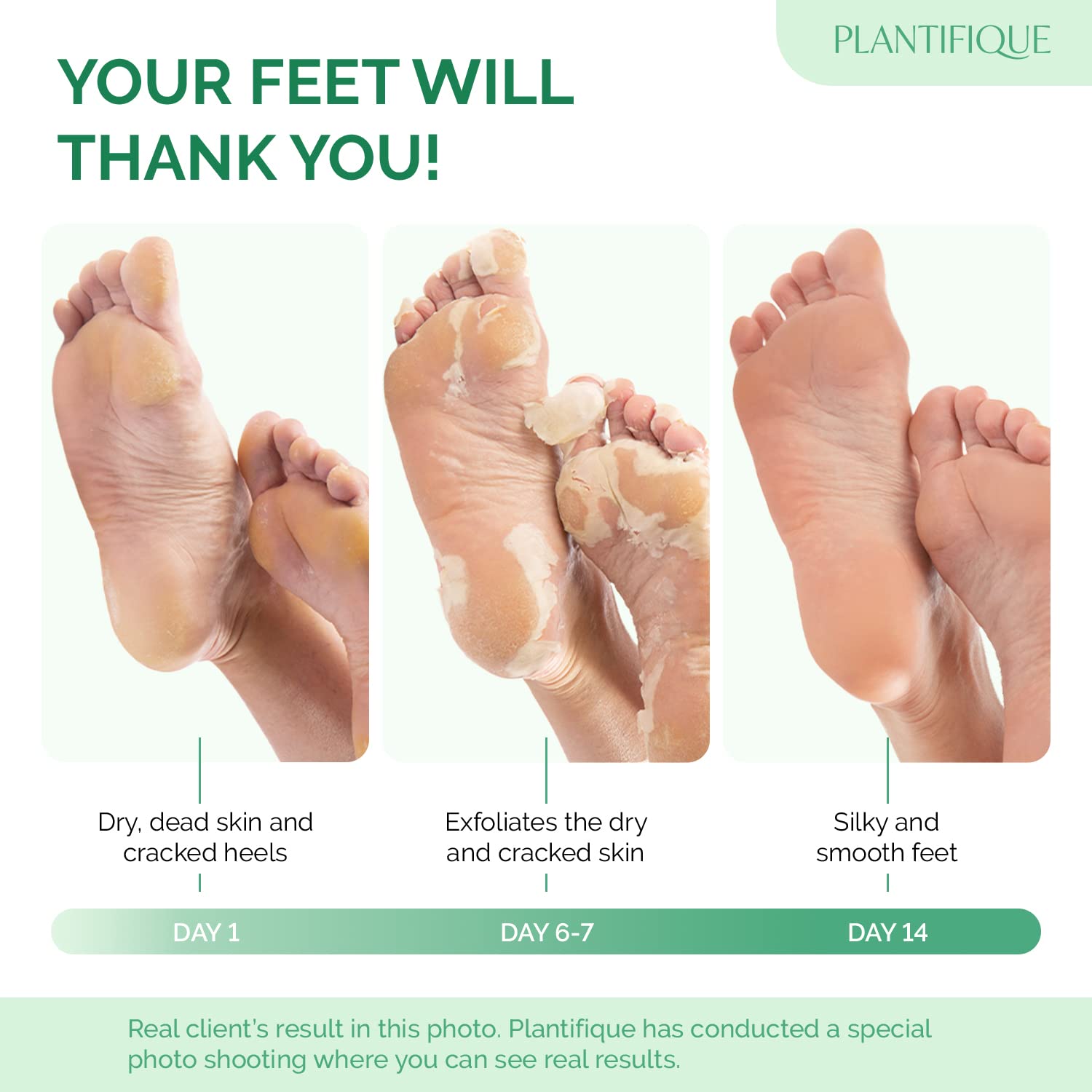 PLANTIFIQUE Foot Peel Mask Peach feet soaking scene to soften dry skin before peeling.